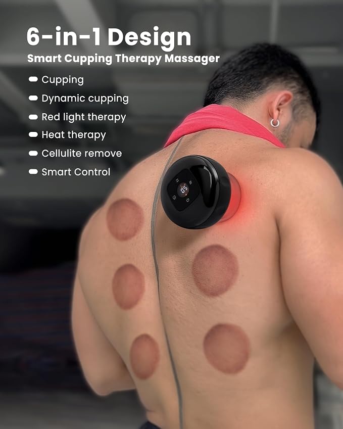 UOTT 6-in-1 Smart Cupping Therapy Massager, 20 Levels Heat & Suction Electric - Image 2