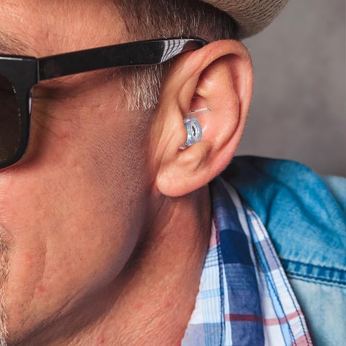 Eargasm High Fidelity Supernova Iridescent Earplugs - Image 6