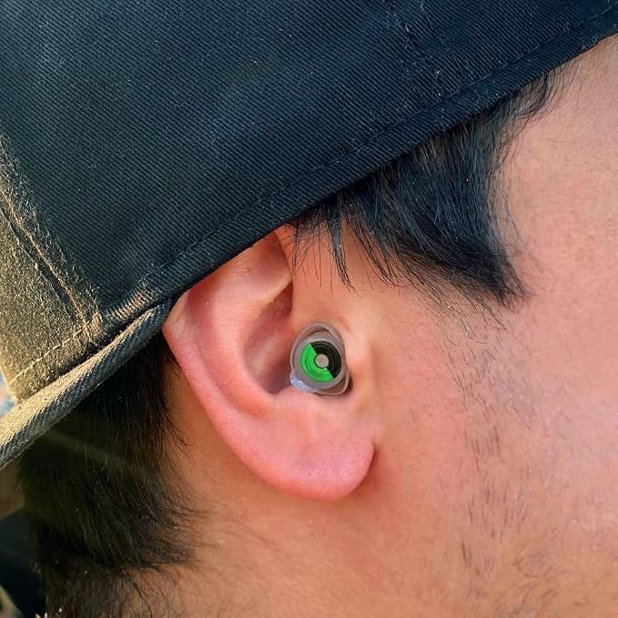 Eargasm High Fidelity Earplugs: When We were Young Edition - Image 3